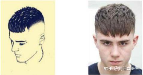 (男人额头宽窄有什么说法)男人额头宽窄也看运势，几指宽最适合面相长相评断