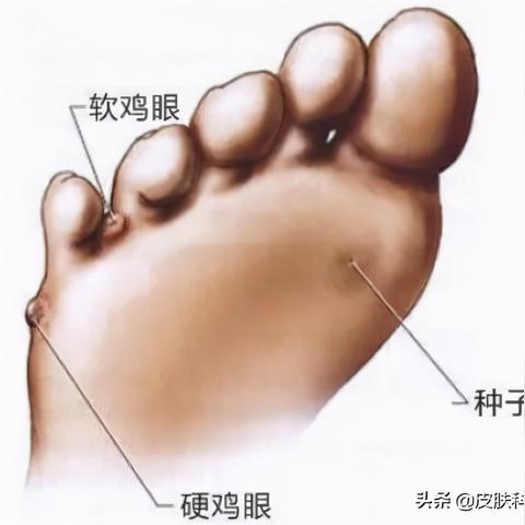 (咪莫特乳膏好用吗)选择优质咪莫特软膏时,哪几个品牌最值得信赖和推荐呢?